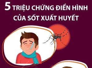 5 triệu chứng điển hình của sốt xuất huyết