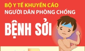 Bộ Y tế khuyến cáo người dân phòng bệnh sởi